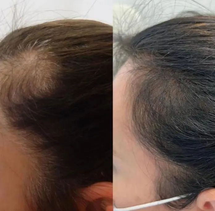 Lavish Hair Growth Oil - Fenugreek & Rosemary