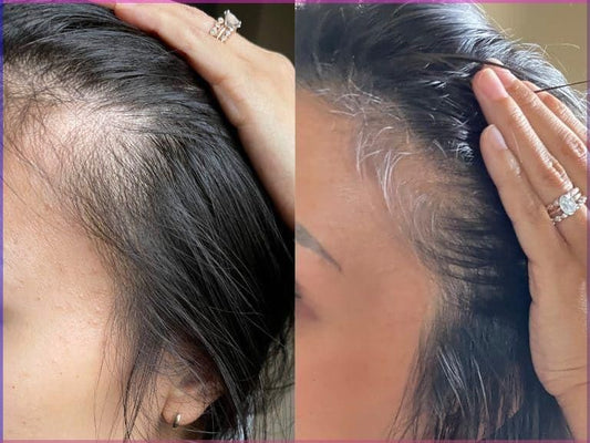 Lavish Hair Growth Oil - Fenugreek & Rosemary