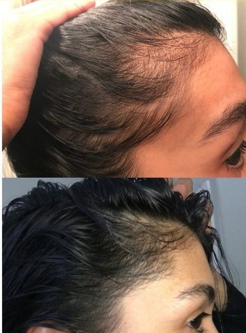 Lavish Hair Growth Oil - Fenugreek & Rosemary