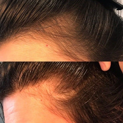 Lavish Hair Growth Oil - Fenugreek & Rosemary